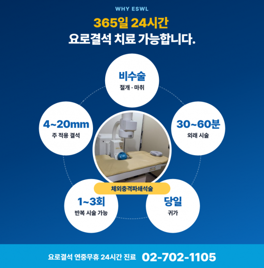 체외충격파쇄석술 받기 전에 가장 많이 묻는 것들